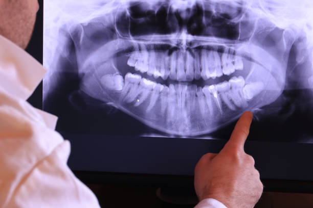 Best Emergency TMJ Treatment in Lochearn, MD